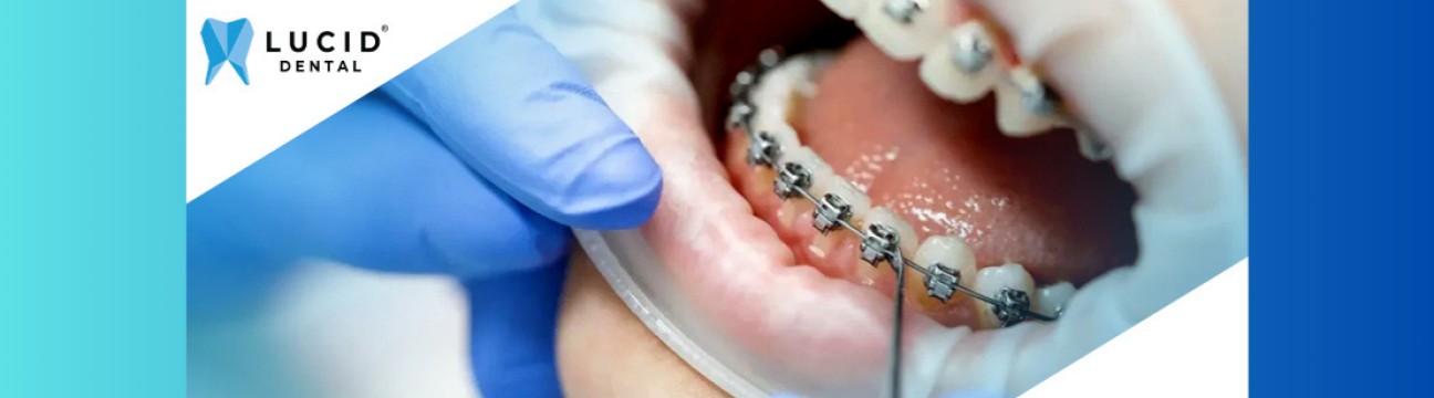 Lucid Dental